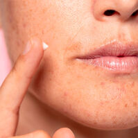 Lotus Radiance Dark Spot Treatment  50ml-214283 Lotus Radiance Dark Spot Treatment  50ml-214283 4